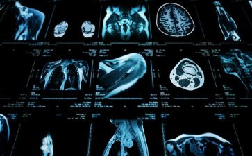 医学影像个人总结6篇